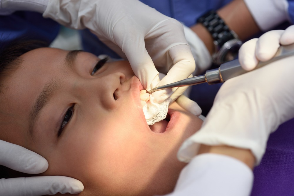 nhổ răng sữa tại phòng khám
